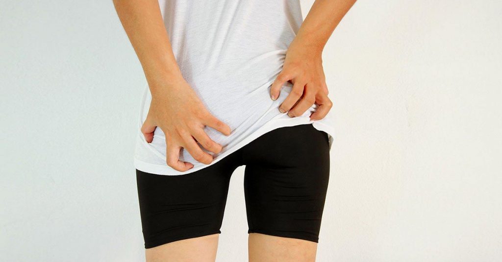 lý do nổi mẩn ngứa ở mông