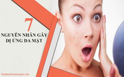 Nguyên nhân gây dị ứng da mặt