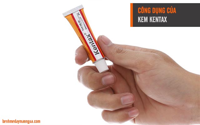 kem Kentax điều trị các bệnh nấm da