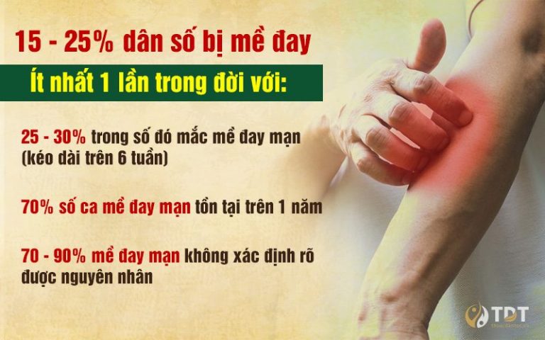 Mề đay mẩn ngứa là bệnh về da phổ biến hiện nay