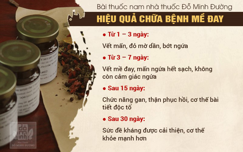 Kết quả điều trị mề đay tại Đỗ Minh Đường