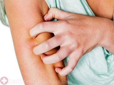 Các nguyên nhân gây ngứa da chớ nên xem thường
