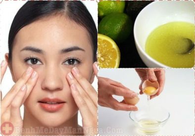 Mẹo trị dị ứng da mặt bằng lòng trắng trứng gà ai cũng bất ngờ