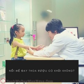 Nổi mề đay thoa rượu có khỏi không ?