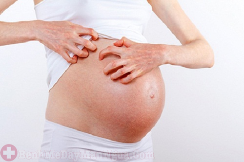 Phát ban đỏ khi mang thai biểu hiện không nên coi thường