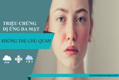 Triệu chứng dị ứng da mặt