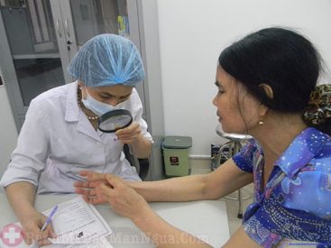 Vì sao bị bệnh nổi mề đay mãn tính vô căn?