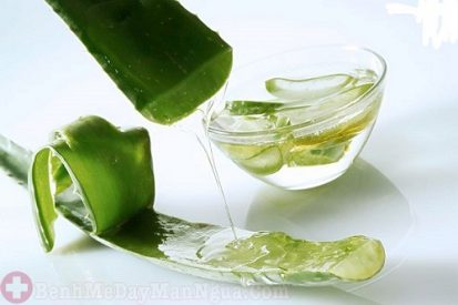 Bật mí cách trị ngứa da đầu bằng nha đam tại nhà đơn giản