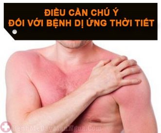Cách khắc phục khi bị dị ứng thời tiết hanh khô