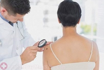 Đột nhiên bị nổi phát ban đỏ nhưng không ngứa phải làm sao?