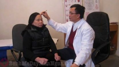 Thực hư chữa mề đay bằng diện chẩn liệu có tốt không?