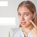 Thoát khỏi chứng dị ứng thời tiết ở mặt thật đơn giản
