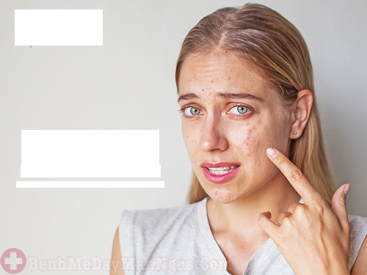 Thoát khỏi chứng dị ứng thời tiết ở mặt thật đơn giản