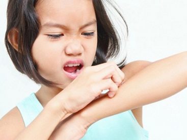 Thường xuyên bị ngứa ngoài da vào mùa đông phải làm sao?