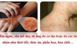 Nguyên nhân và triệu chứng bệnh phong ngứa không nên xem nhẹ