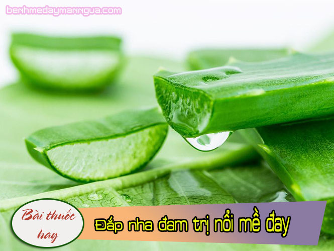 Đắp thịt nha đam lên vùng ngứa trị nổi mề đay