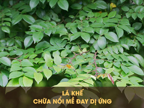 Sử dụng lá khế chữa mề đay là phương pháp dân gian được tin dùng
