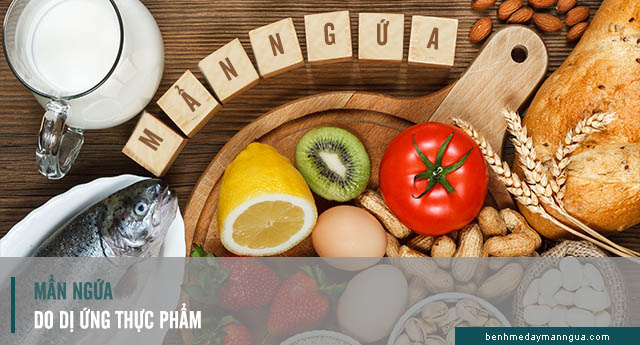 các loại thực phẩm gây mẩn ngứa