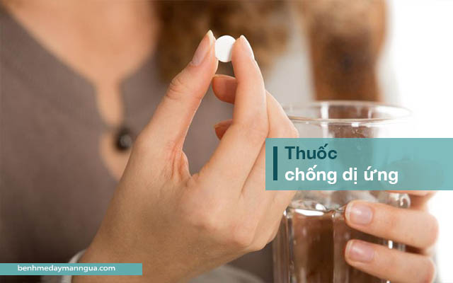 thuốc chống dị ứng, kháng histamine chữa mề đay mẩn ngứa