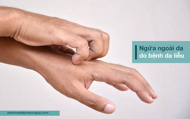 ngứa ngoài da do bệnh da liễu