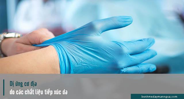 dị ứng do các vật liệu tiếp xúc với da
