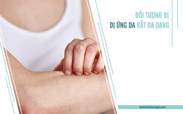 những đối tượng dị ứng da rất đa dạng