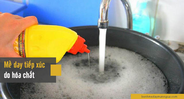 mề đay tiếp xúc do hóa chất