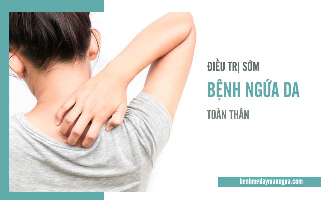 điều trị sớm bệnh ngứa da toàn thân