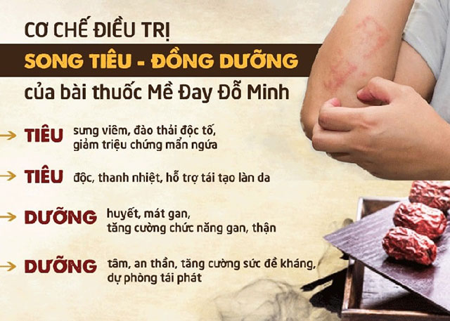 Cơ chế Song tiêu - Đồng dưỡng của bài thuốc trị nổi mề đay của Đỗ Minh Đường