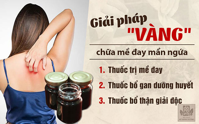 Chữa nổi mề đay vào mùa hè với bài thuốc "3 trong 1" Mề đay Đỗ Minh