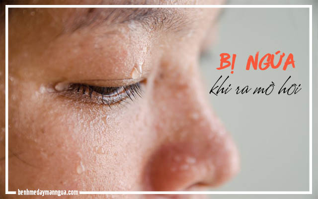 bị ngứa khi ra mồ hôi