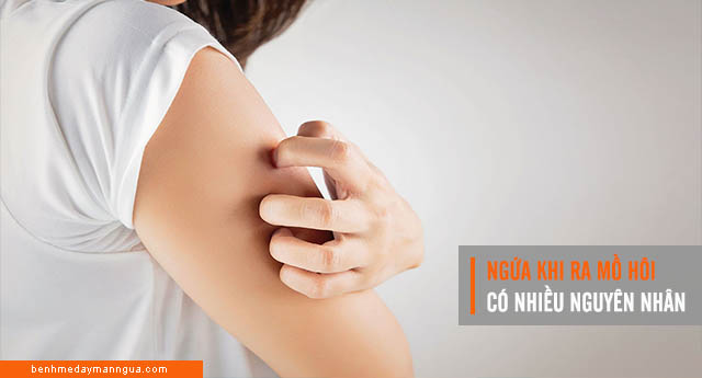 ngứa da khi ra mồ hôi