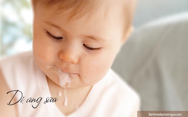 dấu hiệu dị ứng sữa ở trẻ