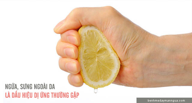 chữa dị ứng bằng nước chanh
