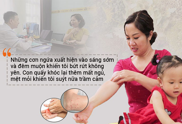 Diễn viên Nguyệt Hằng đã điều trị mề đay mẩn ngứa tại Đỗ Minh Đường và thành công