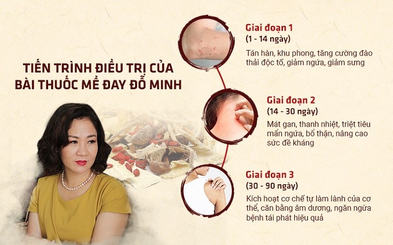 Tiến trình điều trị của bài thuốc Mề đay Đỗ Minh