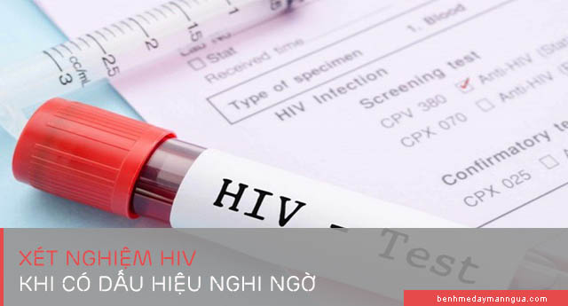 xét nghiệm HIV