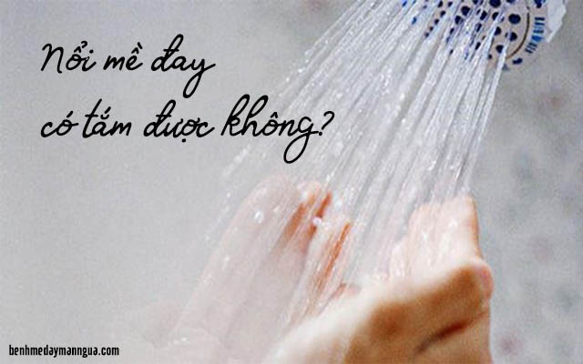 nổi mề đay có tắm được không