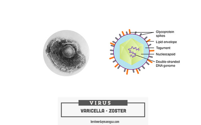 virus Varicella - Zoster gây bệnh Zona thần kinh