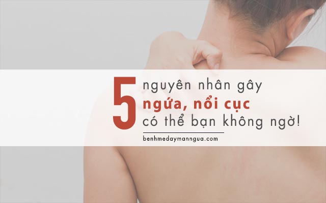 nguyên nhân gây ngứa, nổi cục