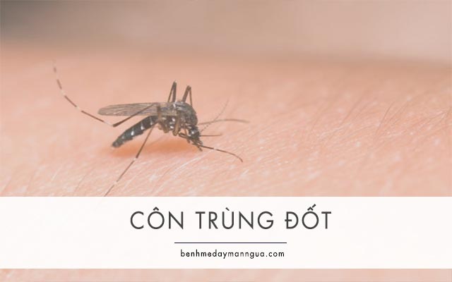 vết đốt của muỗi và các loại côn trùng có thể gây ngứa và nổi sẩn cục