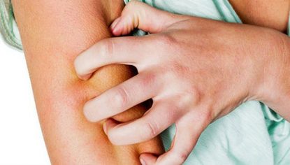Ngứa toàn thân về đêm có thể là triệu chứng của nhiều bệnh lý nguy hiểm