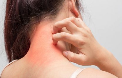 Dị ứng thực phẩm