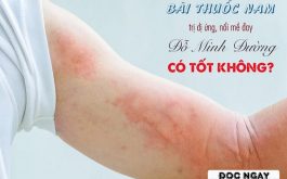 bài thuốc trị dị ứng nổi mề đay