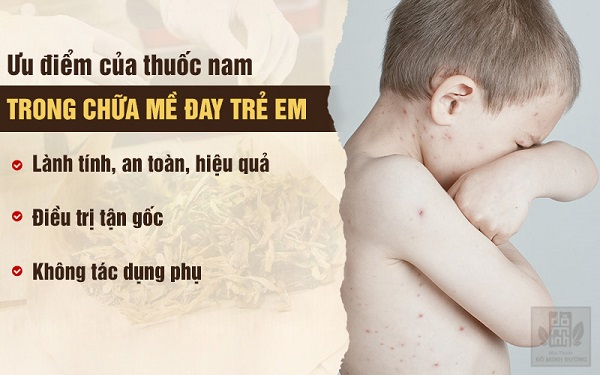 Ưu điểm chữa nổi mề đay, mẩn ngứa ở trẻ em bằng thuốc Nam