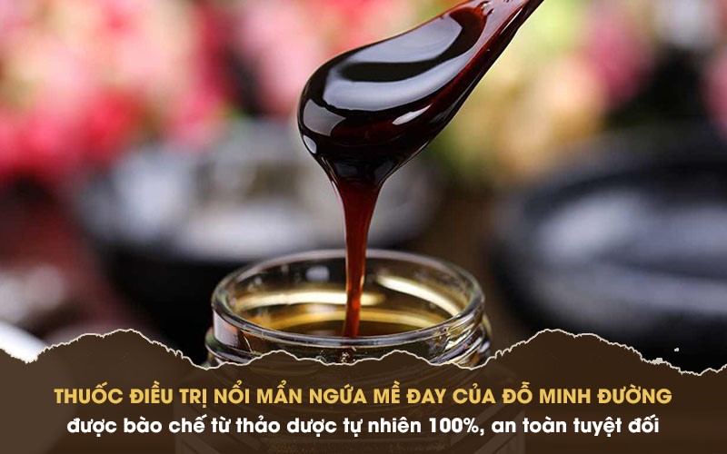 Chữa mề đay mẩn ngứa sau sinh bằng thảo dược tự nhiên