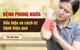 Dấu hiệu và cách trị bệnh phong ngứa hiệu quả