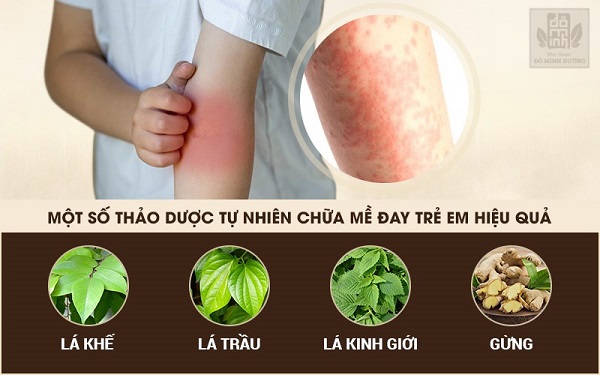 Dùng lá tắm để trị nổi mề đay ở trẻ là phương pháp được nhiều bậc cha mẹ tin dùng