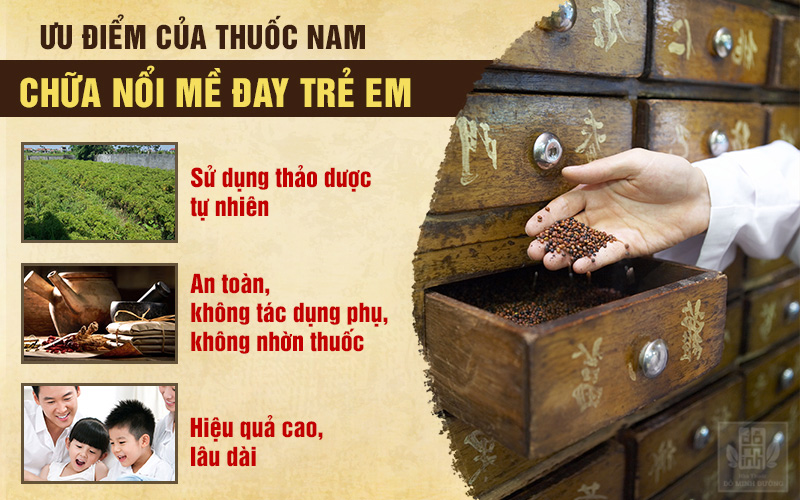 Dùng thuốc nam chữa nổi mề đay trẻ em được ưa chuộng hiện nay