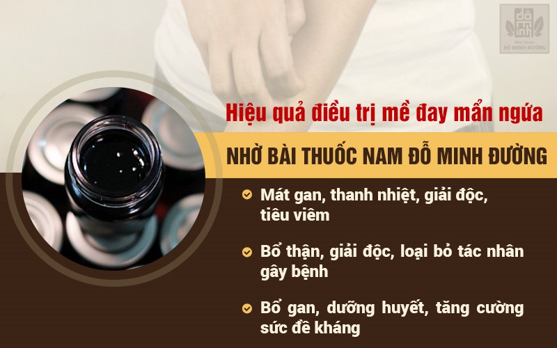 Cơ chế trị bệnh mề đay trẻ em từ bài thuốc nam Đỗ Minh Đường